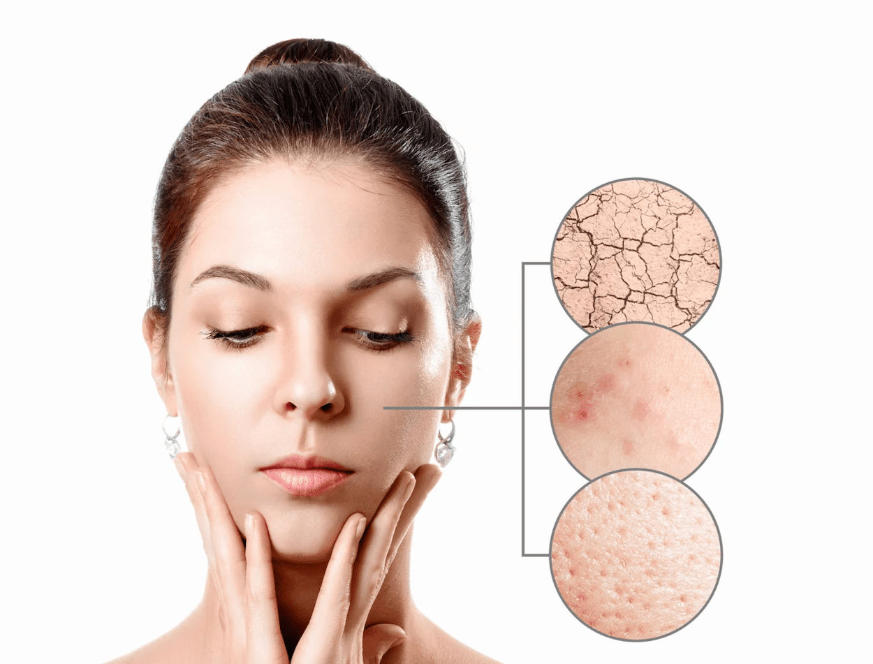 ipl-laser-behandlung-hautklinik-dermatologie-unreinheiten-beseitigen-glatte-haut-kosmetik